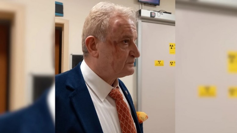 Meslek örgütleri gazeteciye saldırıyı sert bir şekilde kınadı